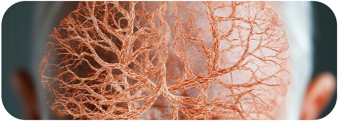 démence vasculaire c'est quoi